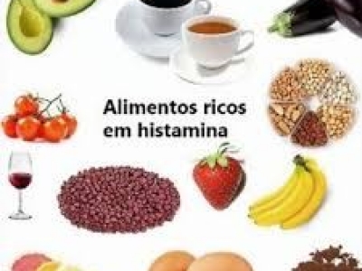 Intolerância à Histamina: sintomas, causas e tratamento