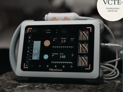 FibroScan ( Elastografia hepática transitória)